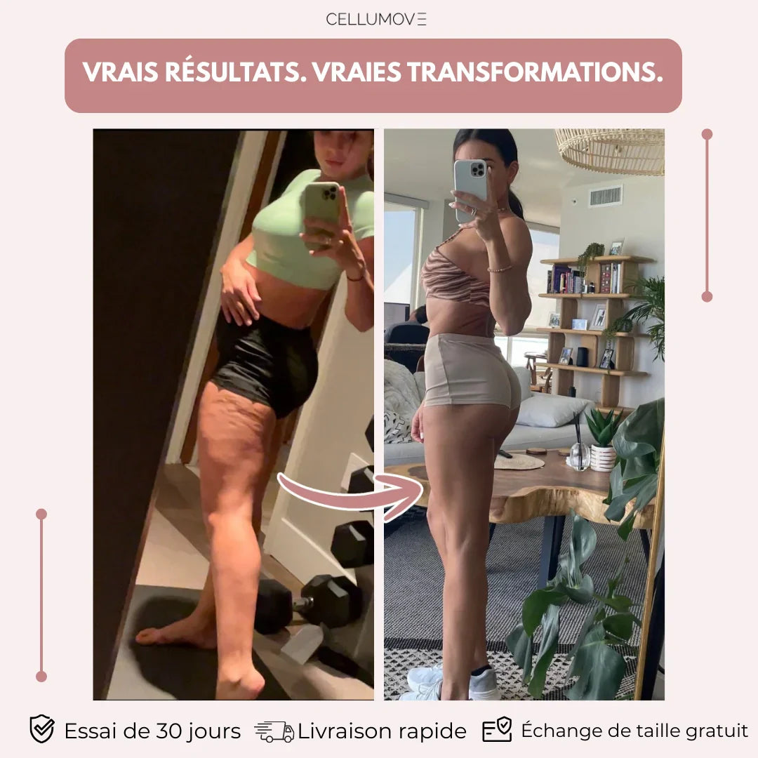 Le legging anti-cellulite pour les femmes qui ont tout essayé — des résultats visibles en 14 jours